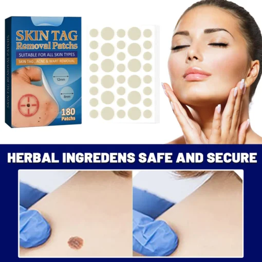 Skin Moles & Moles Removal Stickers - Image 5