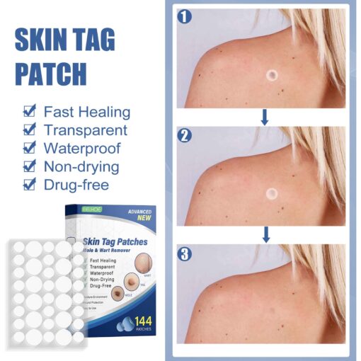 Skin Moles & Moles Removal Stickers - Image 2